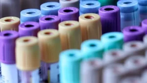 Lee más sobre el artículo Tubos de extracción de sangre al vacío: Una guía completa