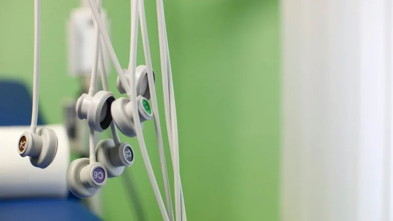 Lee más sobre el artículo Guía Completa sobre Electrodos TENS y ECG: Funcionamiento, Diferencias y Aplicaciones