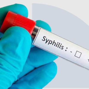 Latex – SEROLOGÍA LUÉTICA (SIFILIS)