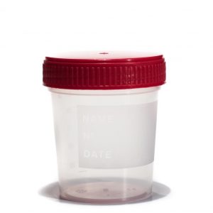 Contenedor orina  150 ml PP C/300 uds.