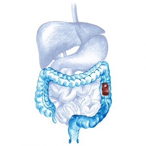 Test Enfermedades Digestivas
